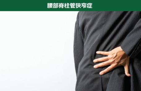 腰部脊柱管狭窄症