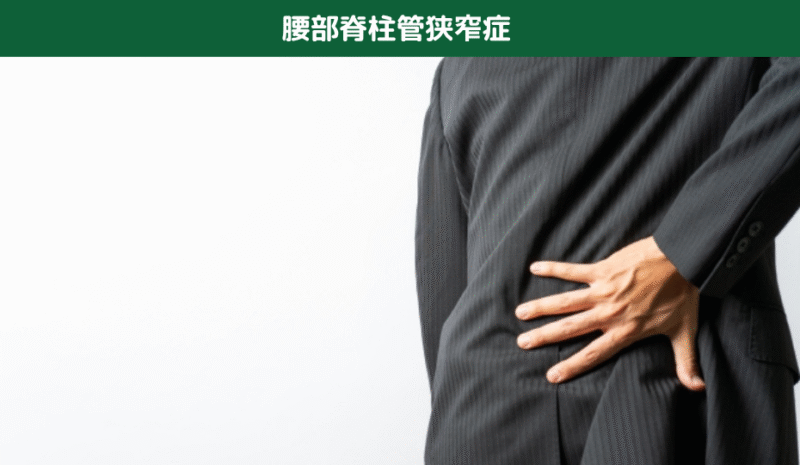 腰部脊柱管狭窄症